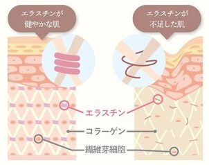エラスチンとはコラーゲンを束ねている3大美容成分の一つ