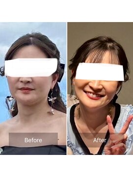 大人気☆レモンボトル_20241225_2